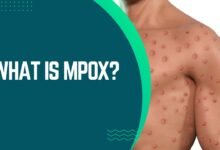 What is Mpox